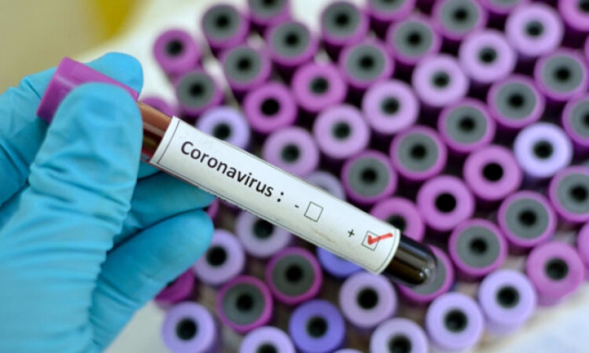 Koronavirusu PANDEMİYA elan olunub